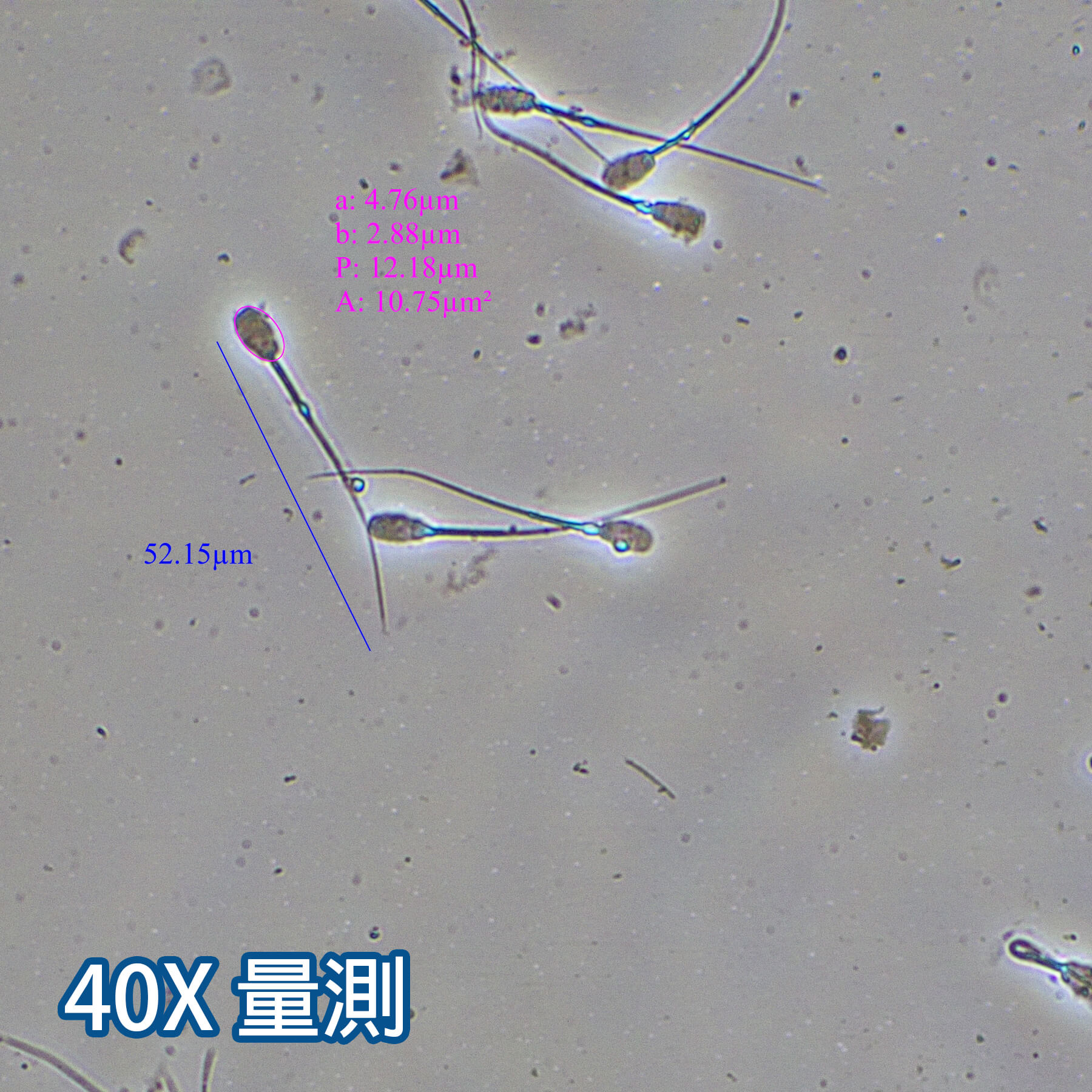 位相差顯微鏡-物鏡倍數：40X量測