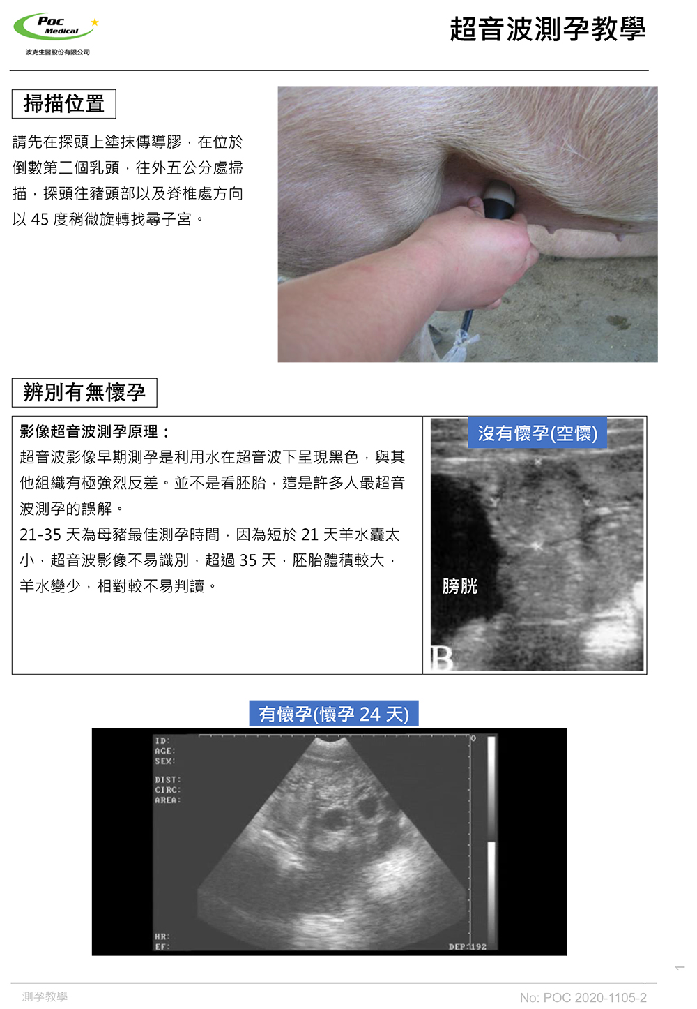 超音波測孕教學-1