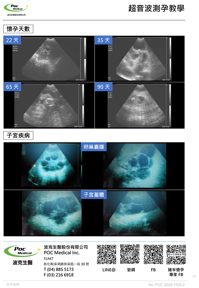 超音波測孕教學-2