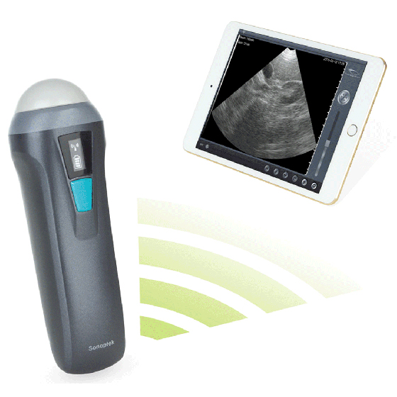 SV-1 超音波測孕器 (型號X2)